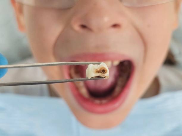 Best Emergency Dental Care for Sports Injuries in Palmer, AK